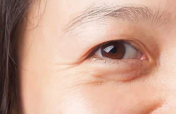 Kem dưỡng mắt có cần thiết không? Kem dưỡng mắt có cần thiết không?
