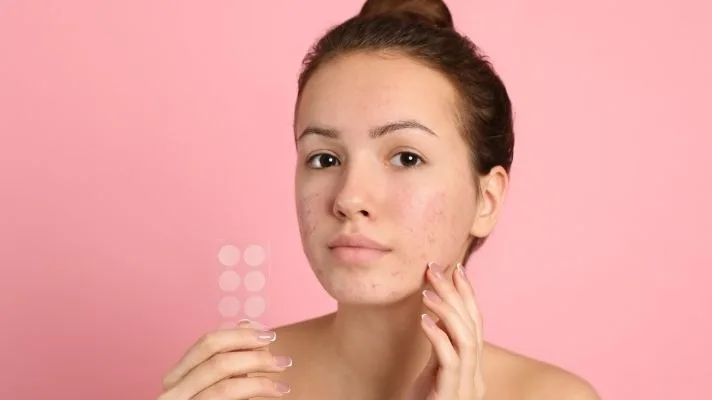 ưu điểm và nhược điểm của miếng dán mụn ưu điểm và nhược điểm của miếng dán mụn