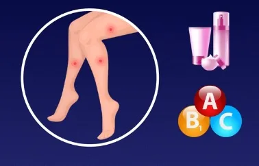 Mụn cơ thể và dấu hiệu sức khỏe xuống cấp ELLE VN