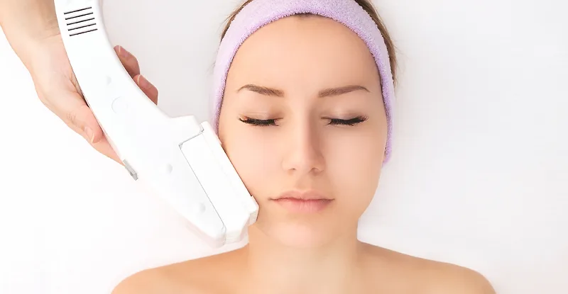 trị sẹo mụn hiệu quả Intense Pulsed Light (IPL) trị sẹo mụn hiệu quả Intense Pulsed Light (IPL)