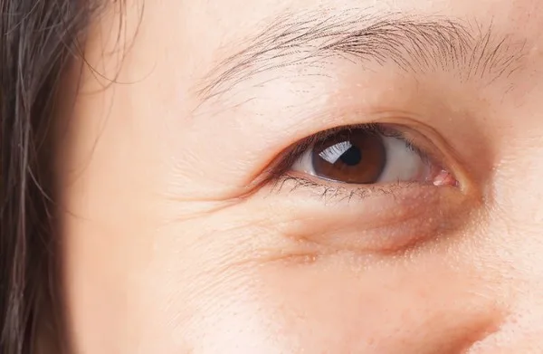 Kem dưỡng mắt có cần thiết không? Kem dưỡng mắt có cần thiết không?