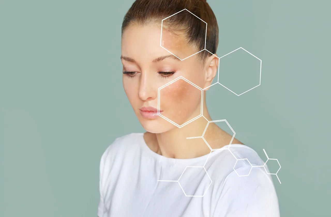 Cải thiện sai cách khiến thâm nám không cải thiện mà còn gây tổn thương cho da. Cải thiện sai cách khiến thâm nám không cải thiện mà còn gây tổn thương cho da.