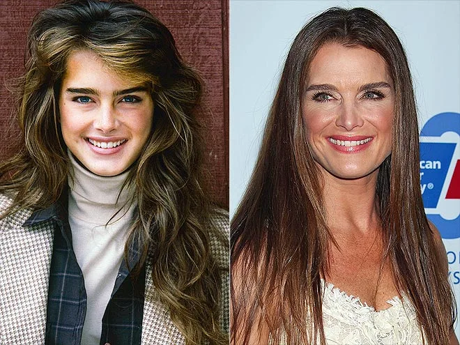 Brooke Shields và khuôn mặt trẻ hơn tuổi thật nhờ liệu pháp tiêm botox