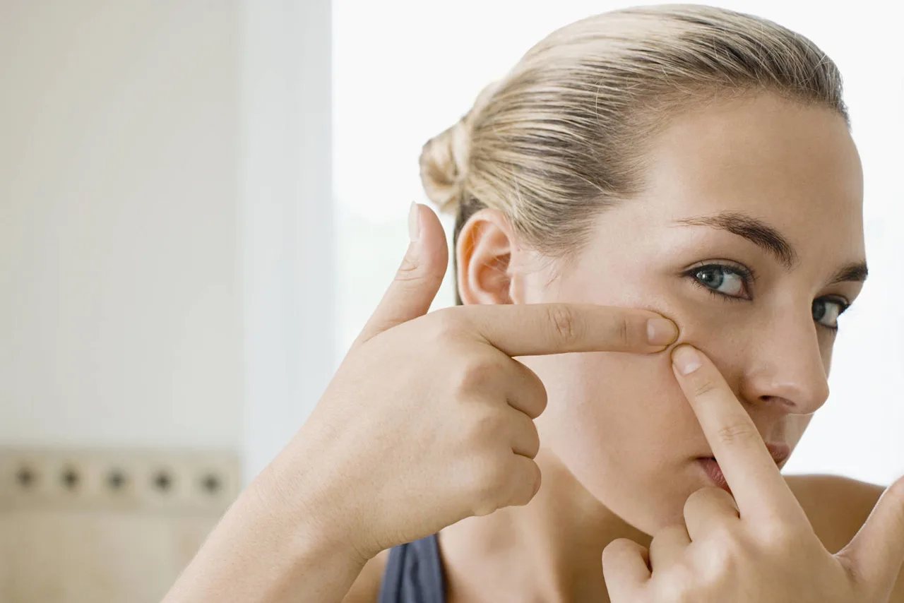 Đa dưỡng ẩm cho da mụn trứng cá Đa dưỡng ẩm cho da mụn trứng cá