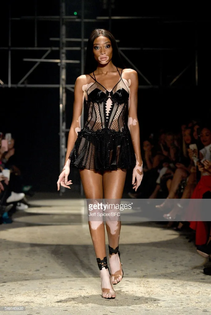 người mẫu Winne Harlow victoria's secret show 2018