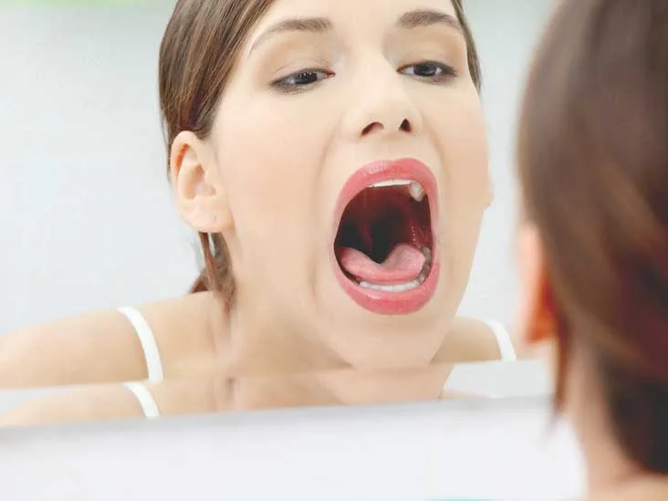 làm sạch răng 4 làm sạch răng 4
