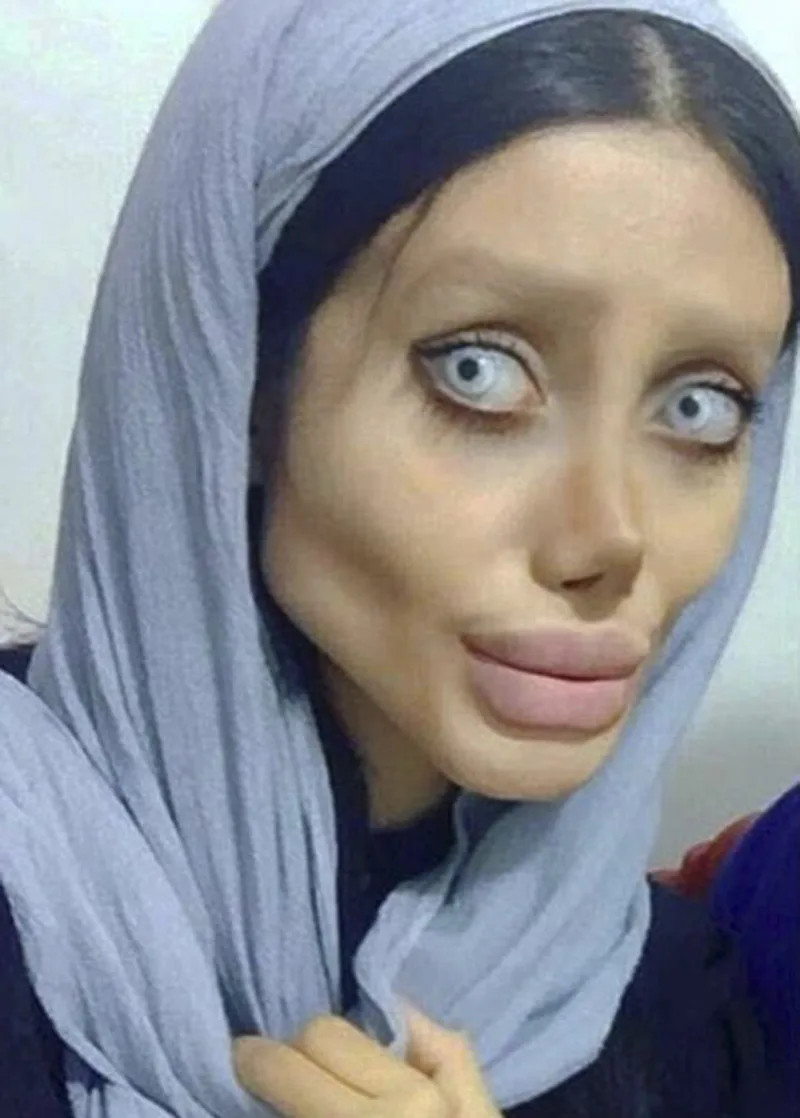 Nổi tiếng sau 50 lần phẫu thuật thẩm mỹ để trở thành Angelina Jolie