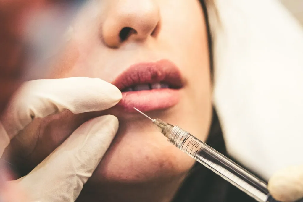 tiêm filler môi hoại tử ảnh hưởng bởi tia UV