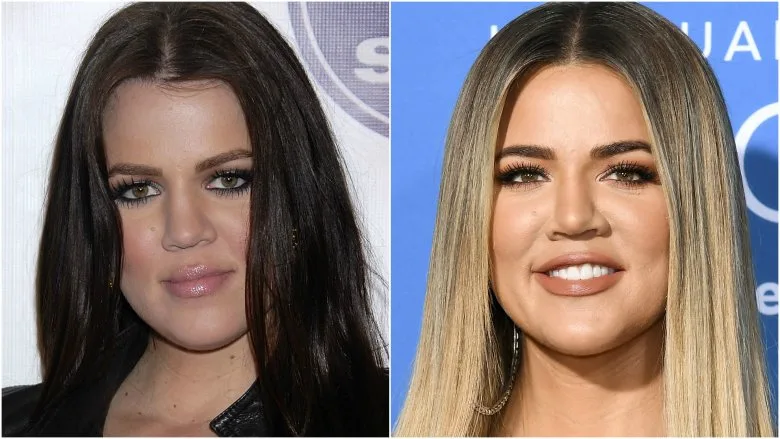 Khloe Kardashian