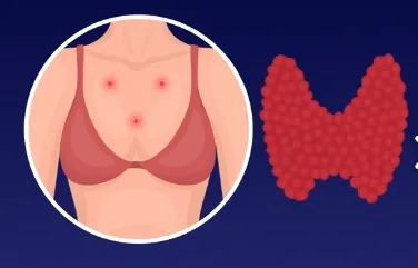 Mụn cơ thể và dấu hiệu sức khỏe xuống cấp ELLE VN