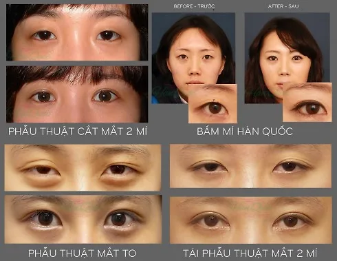 Mắt hai mí là chuẩn mực của sắc đẹp châu Á.