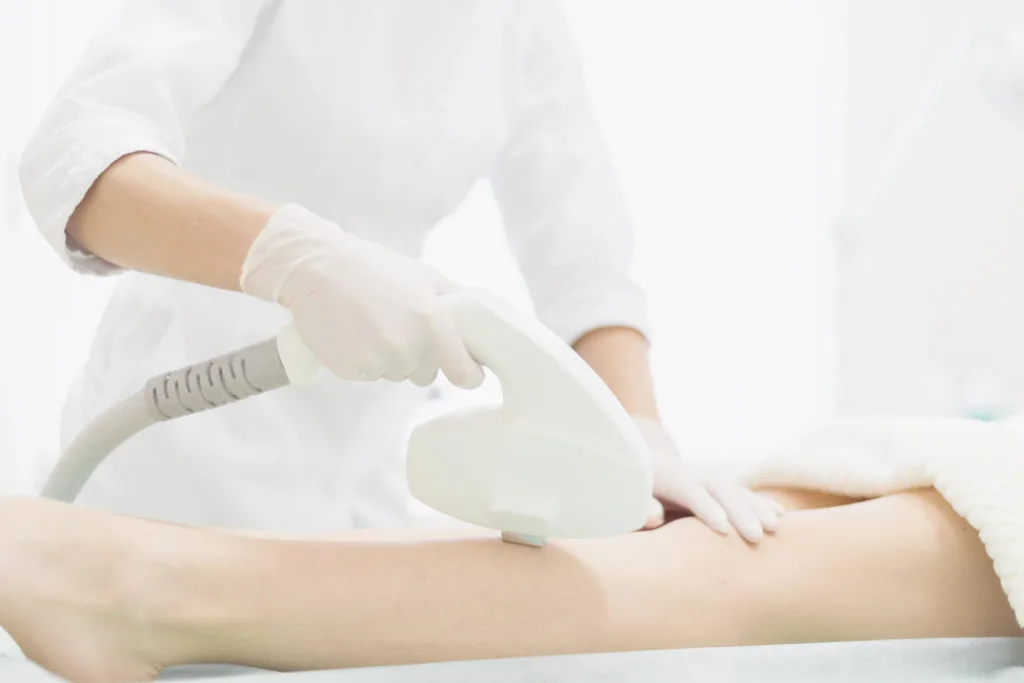 triệt lông chân hiệu quả bằng laser triệt lông chân hiệu quả bằng laser