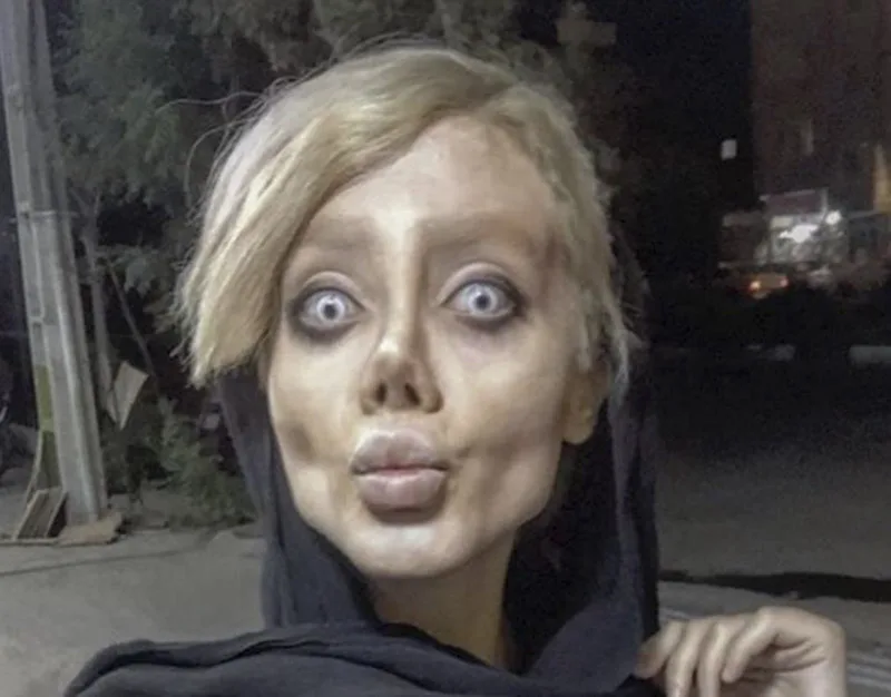 Nổi tiếng sau 50 lần phẫu thuật thẩm mỹ để trở thành Angelina Jolie