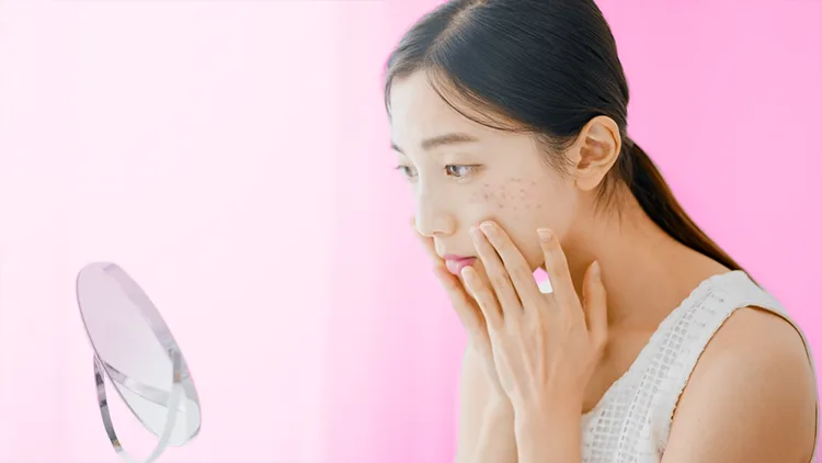 Quá trình cải thiện đốm nâu đòi hỏi rất nhiều sự kiên nhẫn và chi phí Quá trình cải thiện đốm nâu đòi hỏi rất nhiều sự kiên nhẫn và chi phí
