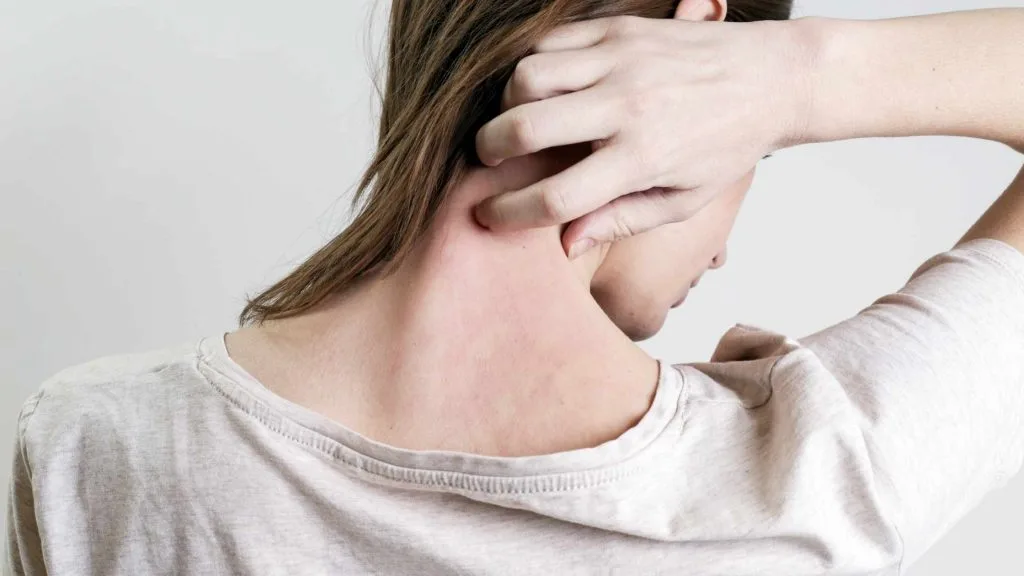 Phát ban là dấu hiệu da bị stress Phát ban là dấu hiệu da bị stress