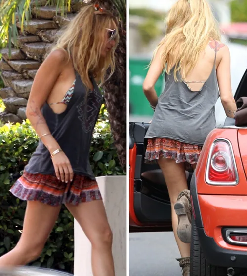 sần vỏ cam blake-lively sần vỏ cam blake-lively