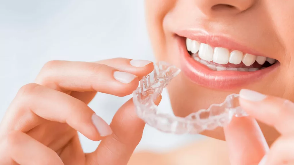 chăm sóc răng miệng - miếng niềng răng trong suốt