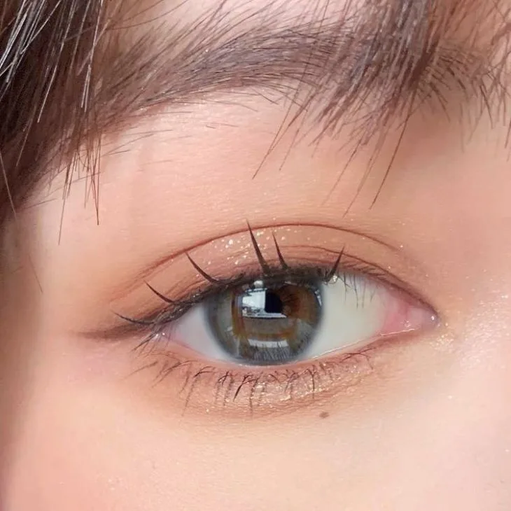 mắt cận