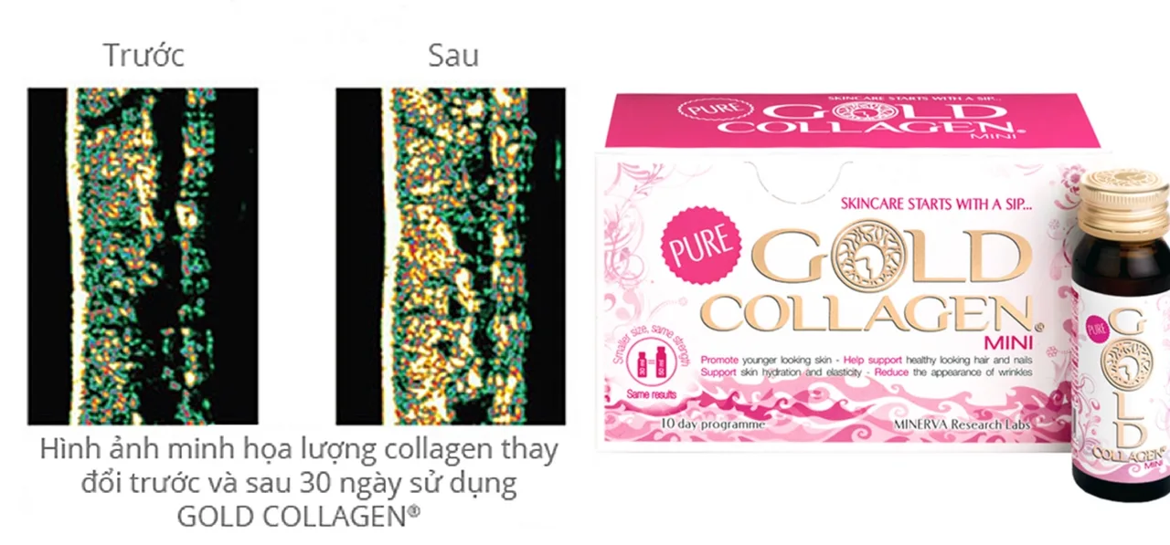 Gold Collagen: Bí quyết vàng để “trẻ mãi không già” Gold Collagen: Bí quyết vàng để “trẻ mãi không già”