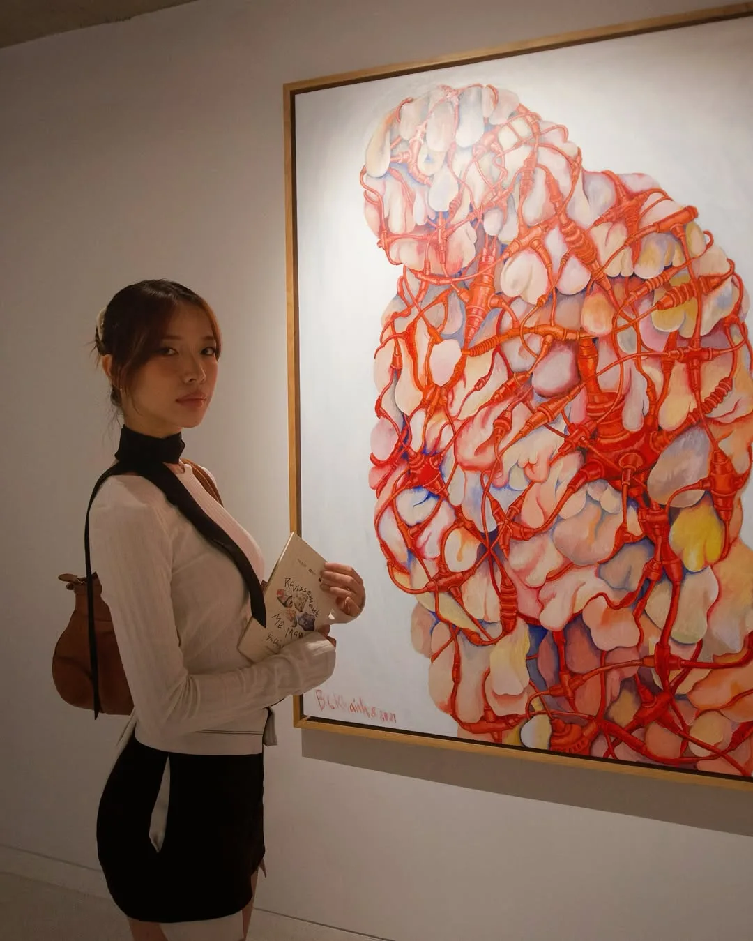 Gu thẩm mỹ Nina
