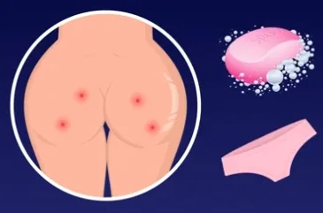 Mụn cơ thể và dấu hiệu sức khỏe xuống cấp ELLE VN