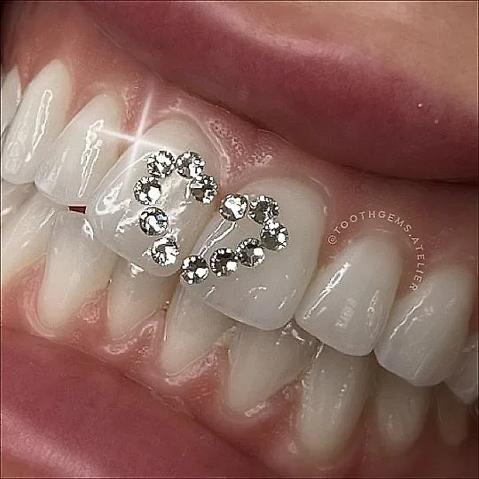 Hàm răng trắng là yêu cầu quan trọng khi thực hiện đính đá lên răng Hàm răng trắng là yêu cầu quan trọng khi thực hiện đính đá lên răng