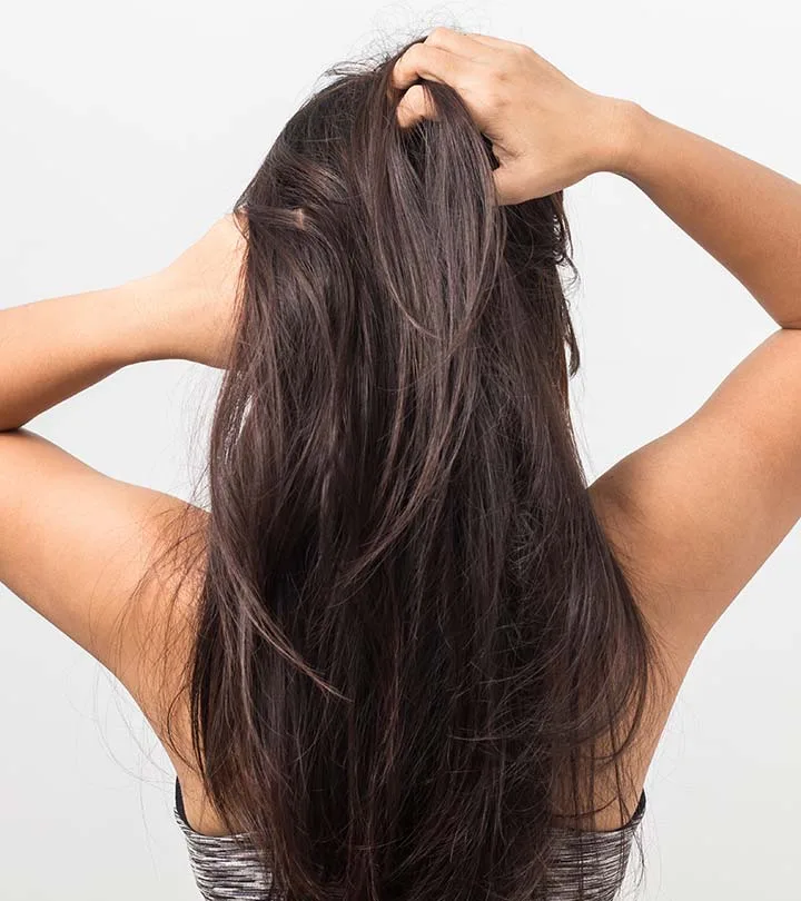 cách trị gàu 2 cách trị gàu 2