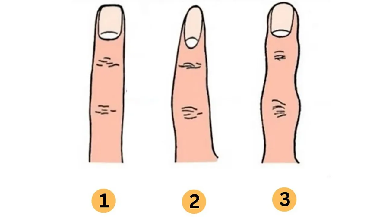 trắc nghiệm hình ảnh ngón tay