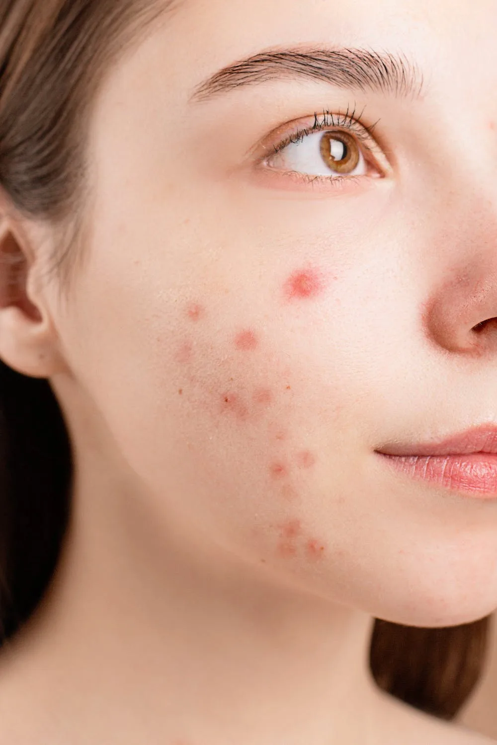 cạo lông mặt da mụn cạo lông mặt da mụn