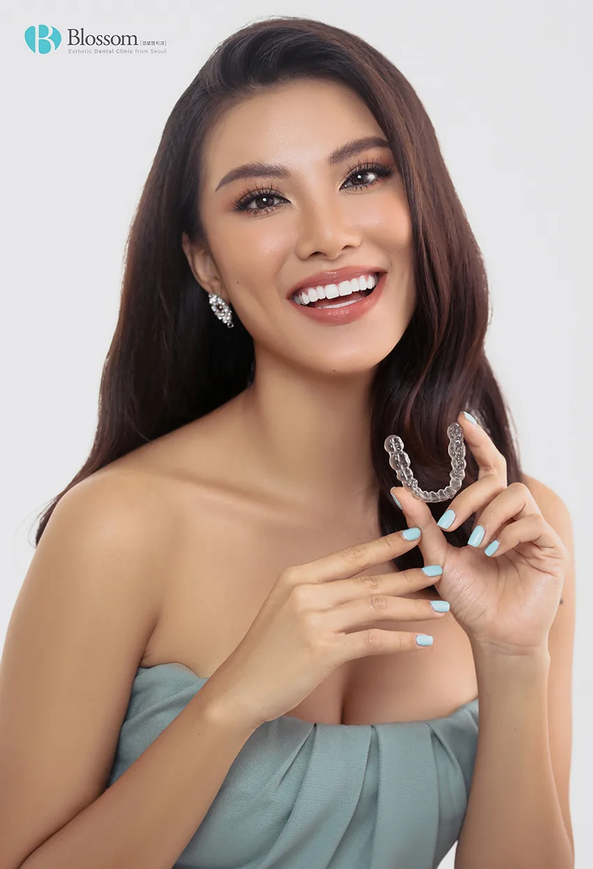 Á hậu Kim Duyên thực hiện dịch vụ Niềng răng 6 MONTHS SMILE của nha khoa Blossom trước khi trước khi tham dự Miss Universe 2021. Á hậu Kim Duyên thực hiện dịch vụ Niềng răng 6 MONTHS SMILE của nha khoa Blossom trước khi trước khi tham dự Miss Universe 2021.