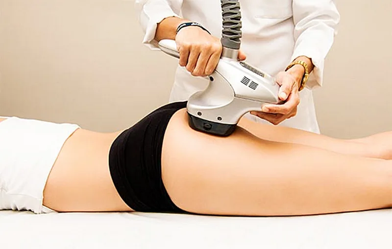 sần vỏ cam velashape sần vỏ cam velashape