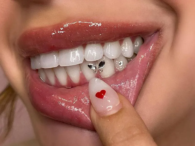Có rất nhiều mẫu mã ấn tượng cho việc đính đá lên răng Có rất nhiều mẫu mã ấn tượng cho việc đính đá lên răng