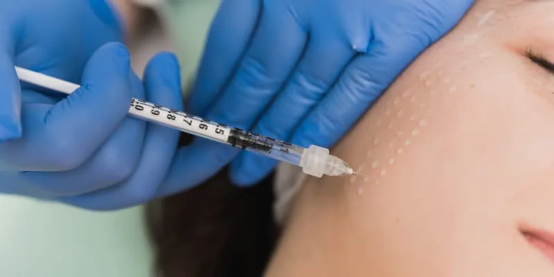 tiêm meso mesotherapy