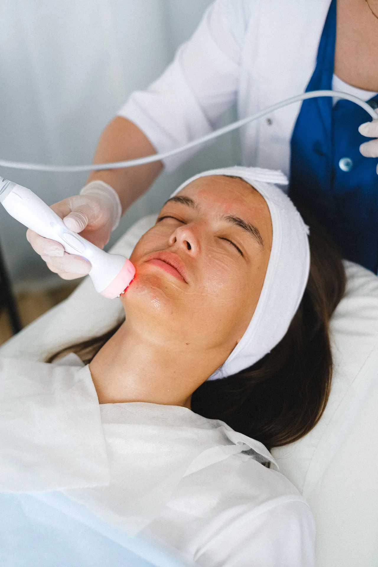 cải thiện kết cấu da bằng cách lăn kim