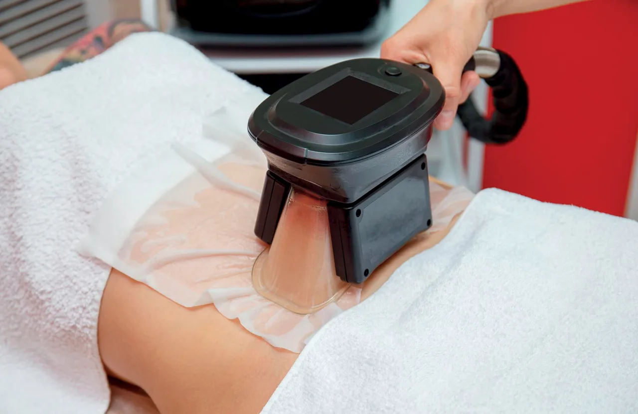 làm đẹp không xâm lấn phương pháp hút mỡ coolsculting làm đẹp không xâm lấn phương pháp hút mỡ coolsculting