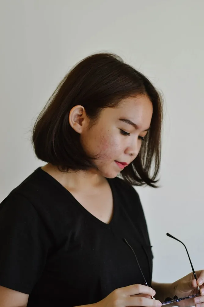 vì sao mụn xuất hiện? vì sao mụn xuất hiện?