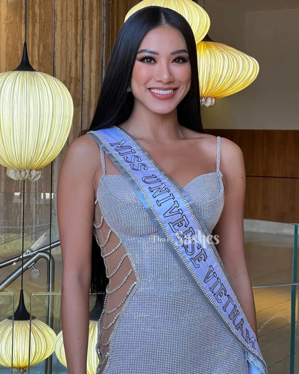 Á hậu Kim Duyên thực hiện dịch vụ Niềng răng 6 MONTHS SMILE của nha khoa Blossom trước khi trước khi tham dự Miss Universe 2021. Á hậu Kim Duyên thực hiện dịch vụ Niềng răng 6 MONTHS SMILE của nha khoa Blossom trước khi trước khi tham dự Miss Universe 2021.