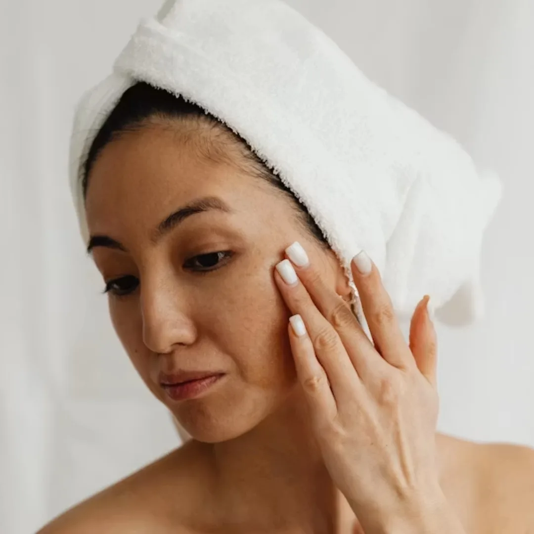 cô gái làm laser giúp hỗ trợ điều trị da thâm do mụn