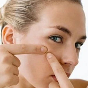 Cách chăm sóc da mặt khi bị mụn