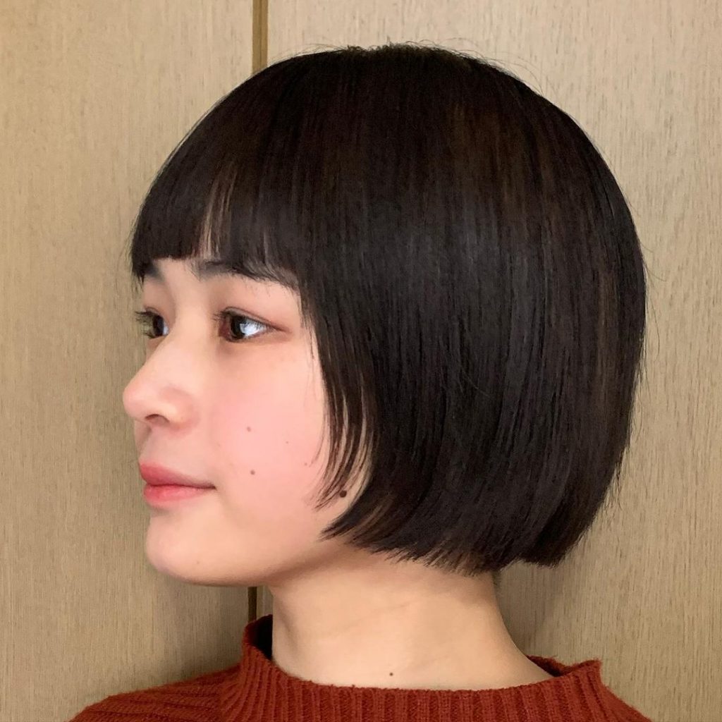 căng chỉ trẻ hoá làn da căng chỉ trẻ hoá làn da