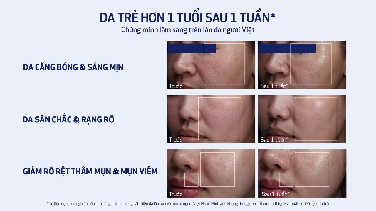 Hình ảnh kết quả nghiên cứu trên làn da bệnh nhân Việt Nam từ Obagi.