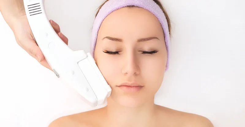 trị sẹo mụn hiệu quả Intense Pulsed Light (IPL) trị sẹo mụn hiệu quả Intense Pulsed Light (IPL)