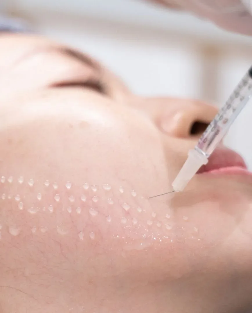 tiêm meso mesotherapy