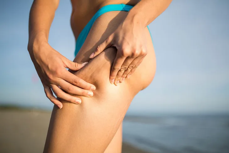 05 nguyên nhân và điều trị cellulite sần vỏ cam 05 nguyên nhân và điều trị cellulite sần vỏ cam