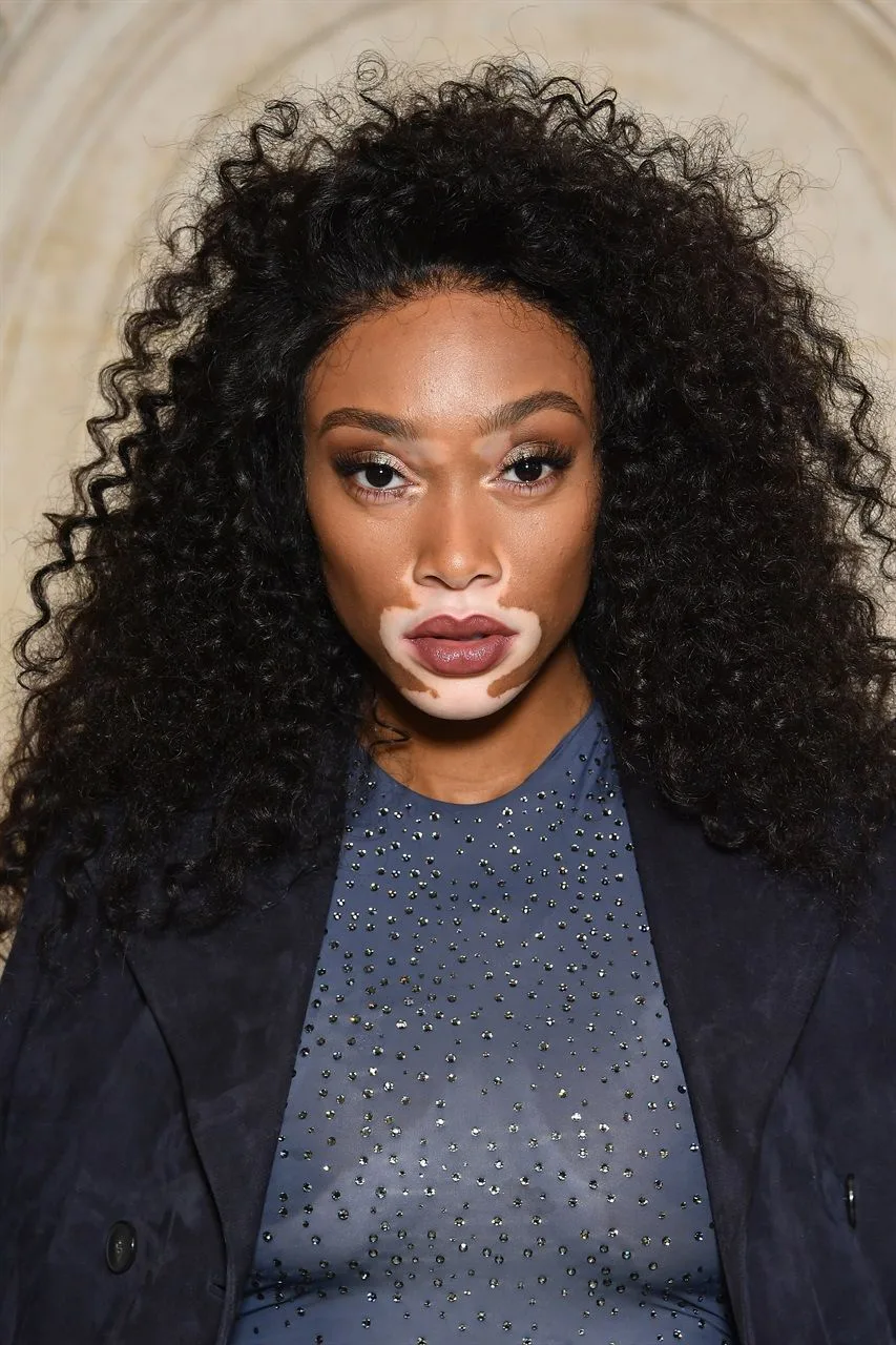 Winnie Harlow và tóc layer Winnie Harlow và tóc layer