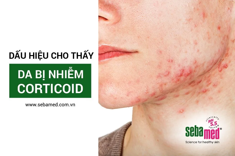 Những nguyên nhân nào khiến da mất cân bằng độ pH? Những nguyên nhân nào khiến da mất cân bằng độ pH?