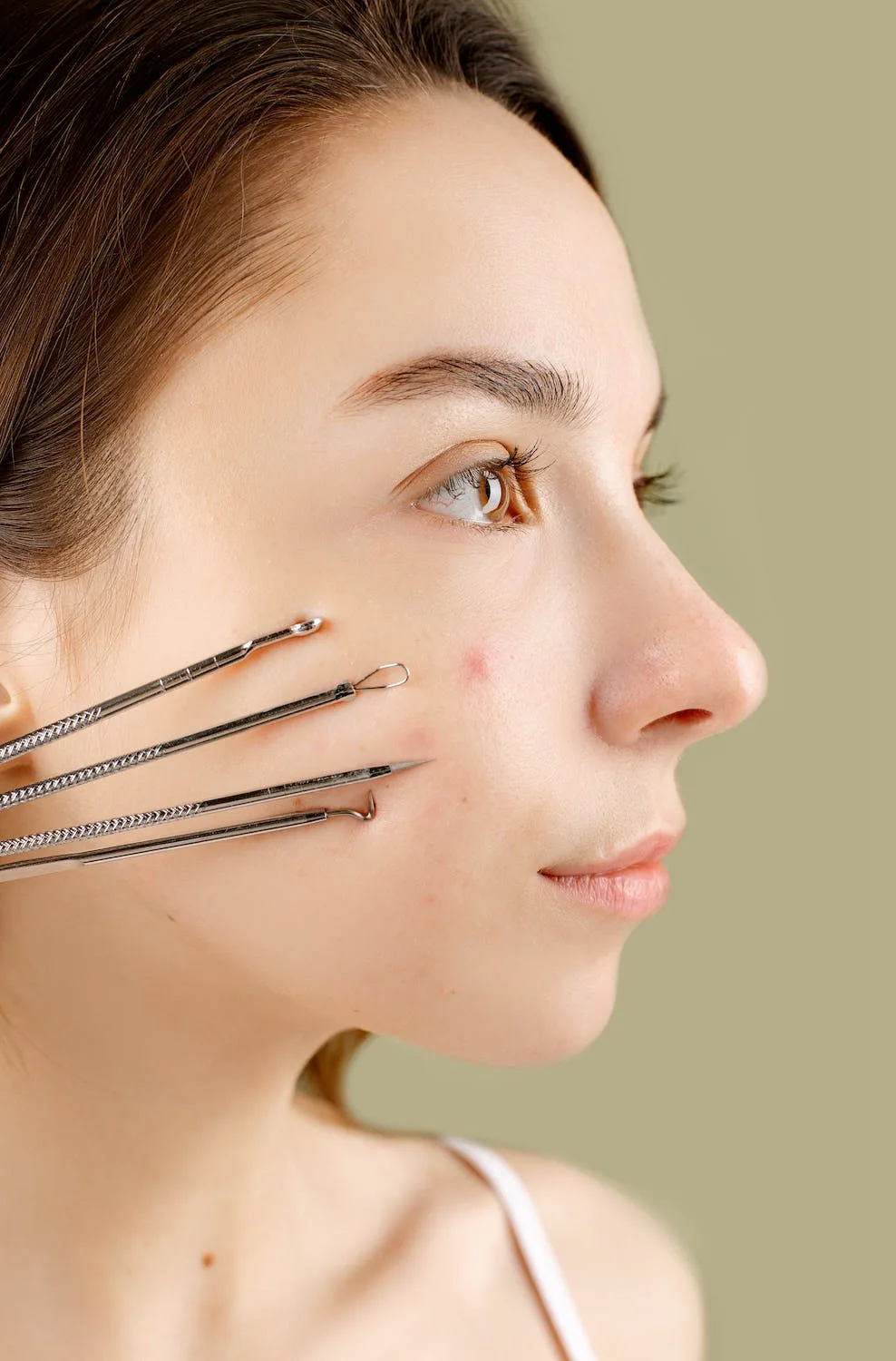 có nên tự xử lý nặn mụn có nên tự xử lý nặn mụn