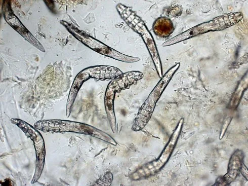 Tác hại của kem trộn đối với làn da Demodex làm tắc nghẽn các nang và ống dẫn của tuyến bã nhờn làm tăng sản biểu mô, xác và chất thải của Demodex có thể gây ra phản ứng dị ứng. Lúc này mặt bệnh nhân sẽ đỏ, ngứa thường xuyên, người bệnh có thể có cảm giác như kiến bò trên da mặt, đặc biệt vào buổi tối.