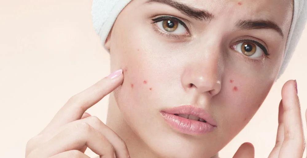 Cách chăm sóc da mặt cho từng loại da - không dễ như bạn tưởng! Cách chăm sóc da mặt cho từng loại da - không dễ như bạn tưởng!