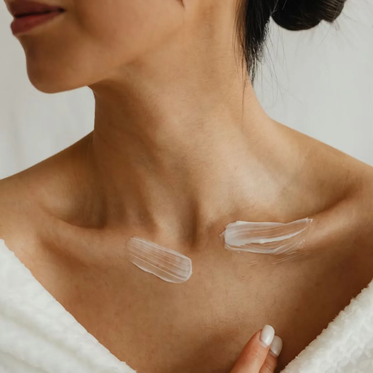 Thoa kem dưỡng phù hợp cho vùng da bị bỏng